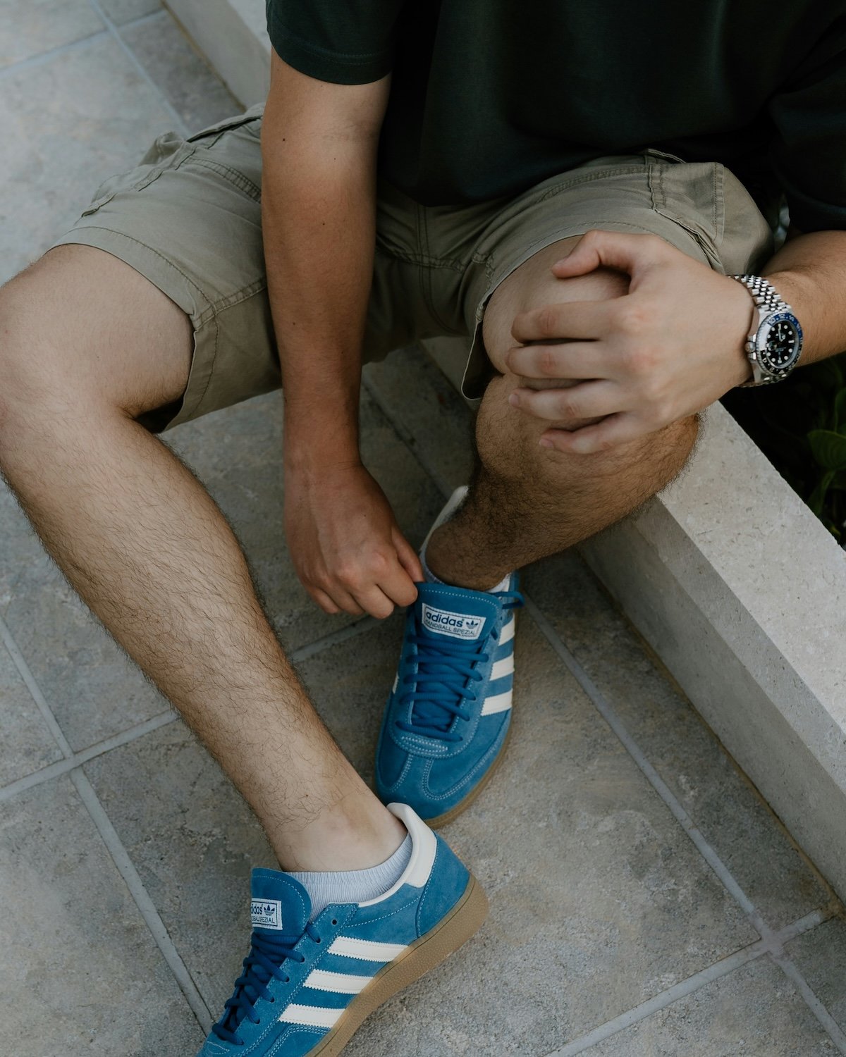 leg pain